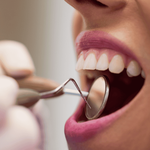 Root Canal in Mexico - Cost, Clinics, Dentists, Packages